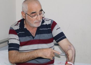 17 kez ameliyat oldu, çürüyen kolu doku nakli ile kurtuldu